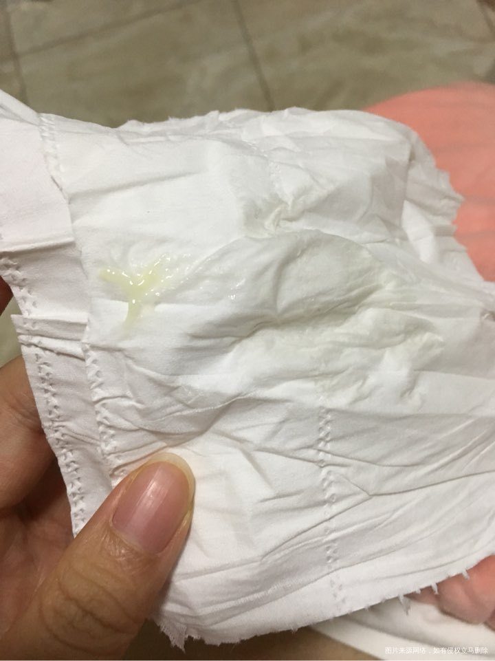 孕2月……出青黄色分泌物