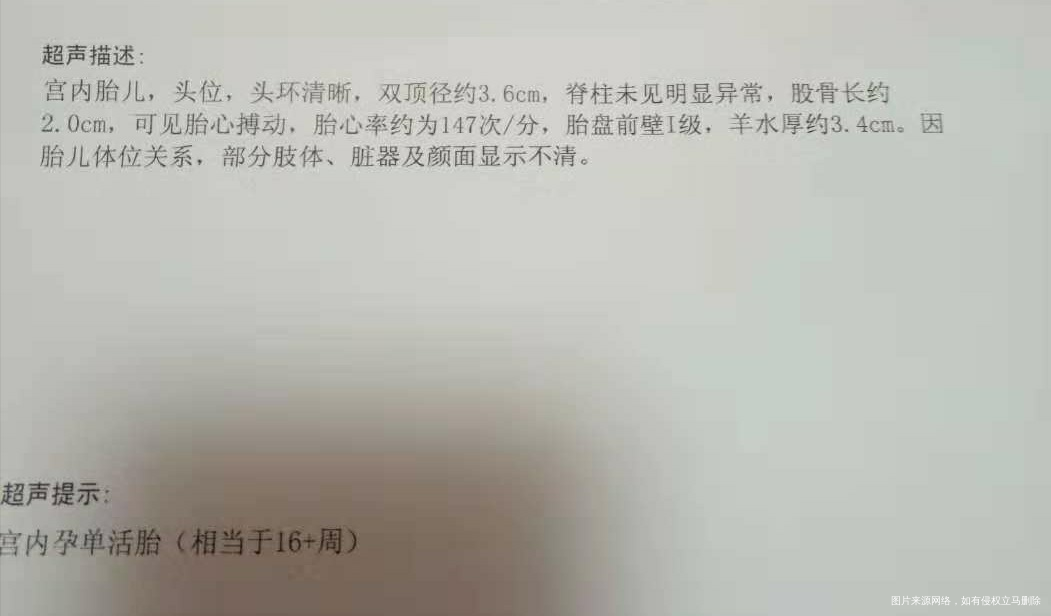 医生帮忙看看B超单子