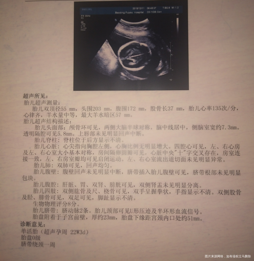 麻烦医生进来看看,我的系统彩超的报告单