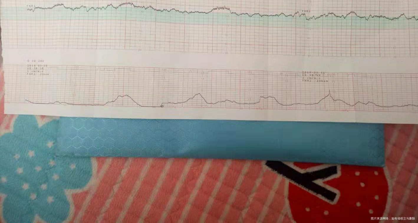 麻烦医生进来看看,需要住院吗?