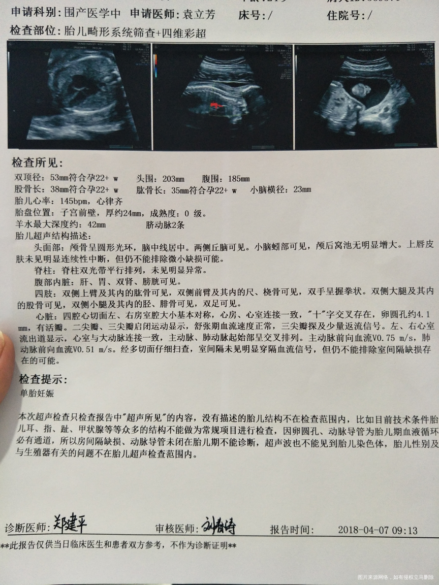 在线医生给看下四维结果