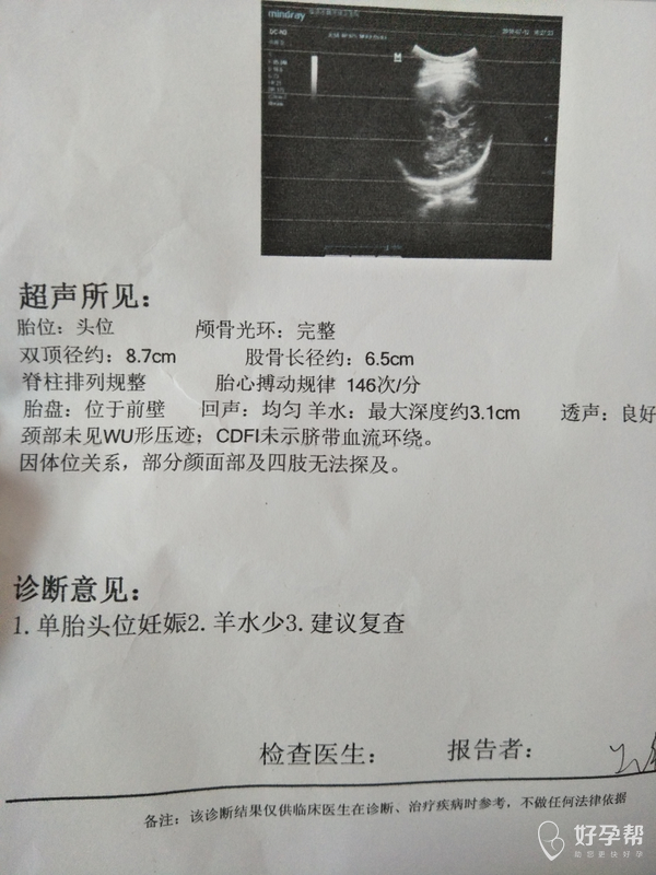 孕37周 今天复查羊水深度才3.