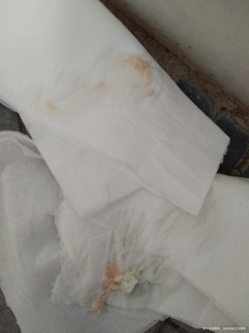 移植后 查完翻倍了,麻烦医生给看看