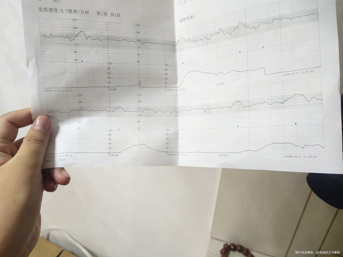 39+4白带有血丝 求助医生
