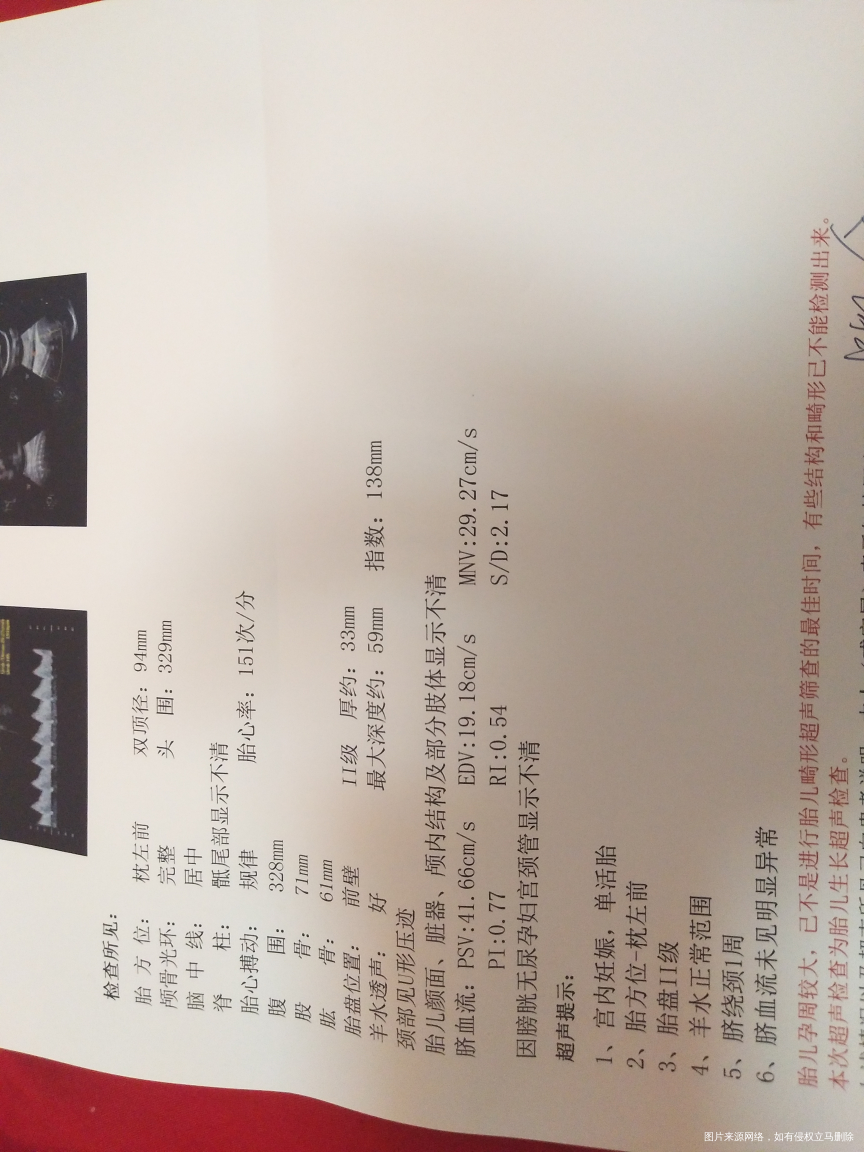 医生帮忙看看帮忙看看