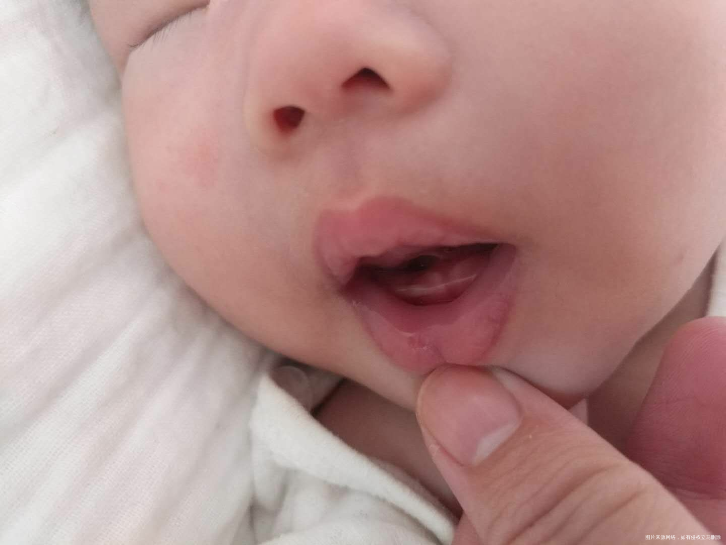 姐妹们帮忙看看宝宝这是长牙了吗?