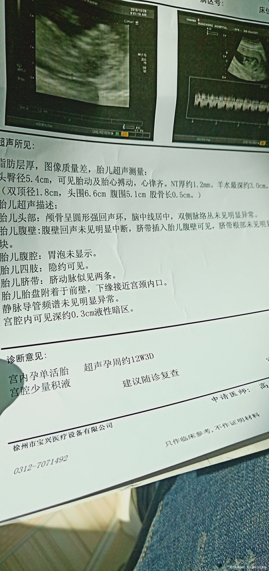 11周+6今天做的检查,宫腔少量积液。