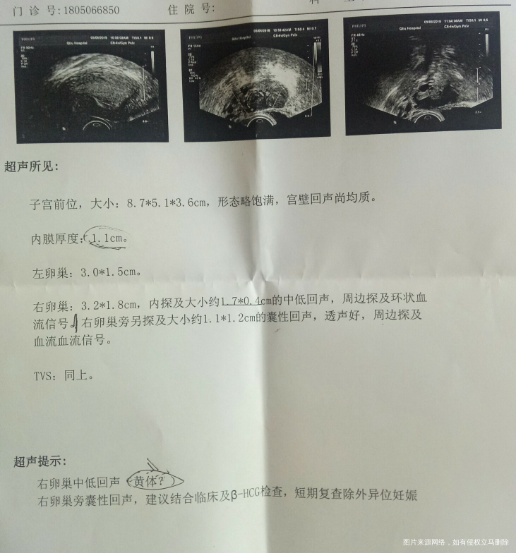 求医生帮忙看一下,宫外孕的可能性大吗?