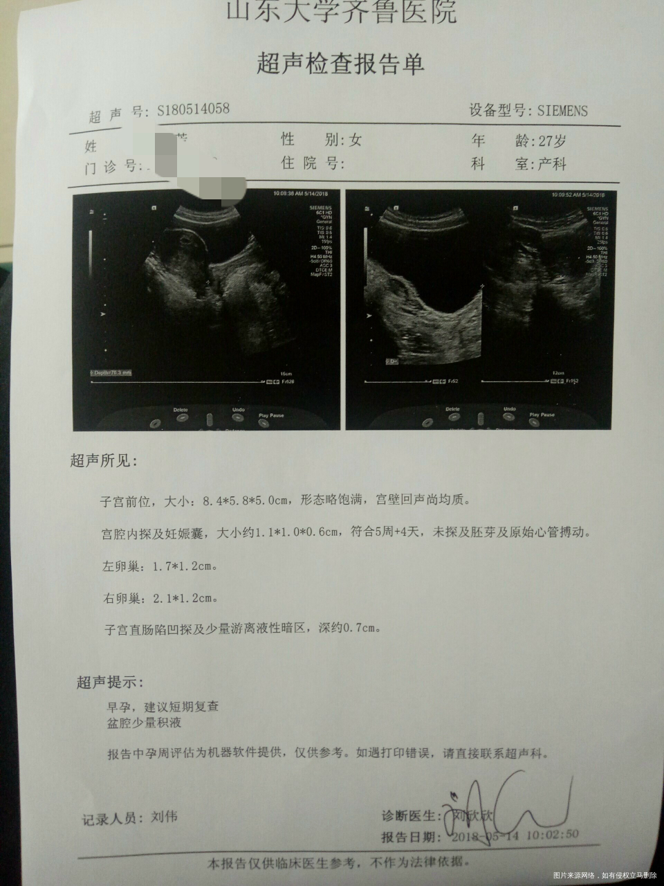 麻烦大夫给看下结果怎么样?还用继续吃药(地屈孕酮片和黄体酮胶囊)吗?