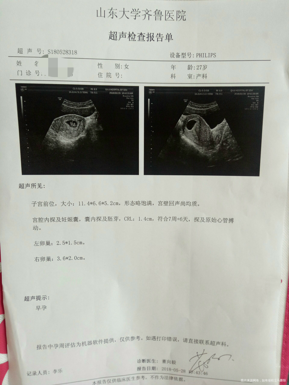 麻烦大夫给看下结果怎么样?还用继续吃药(地屈孕酮片和黄体酮胶囊)吗?