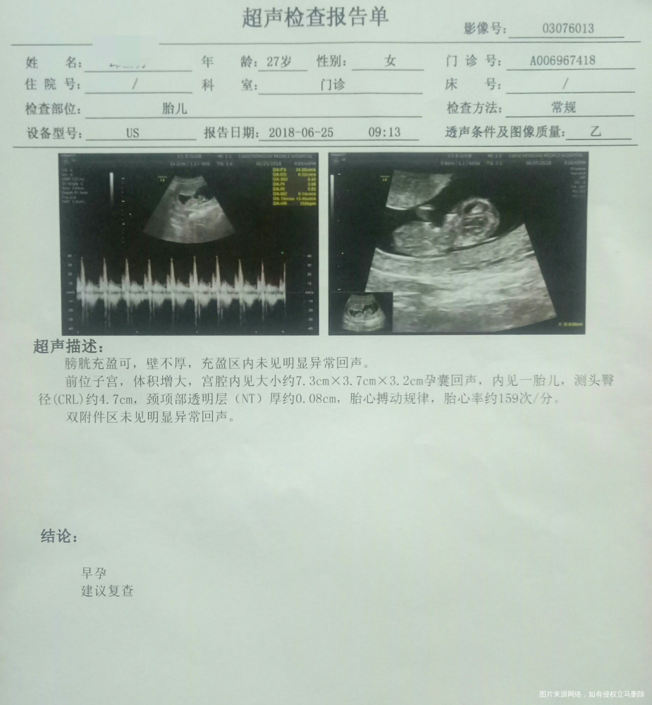 麻烦大夫看下符合孕周天数吗?nt正常吗?12周+6天