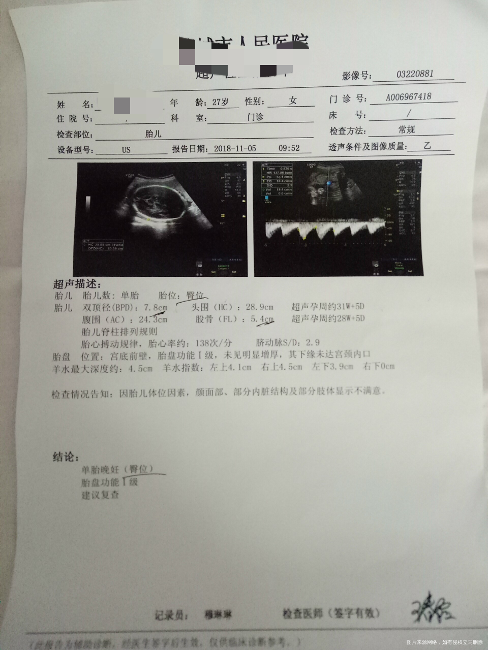 麻烦大夫给看下B超结果?孕周31+6