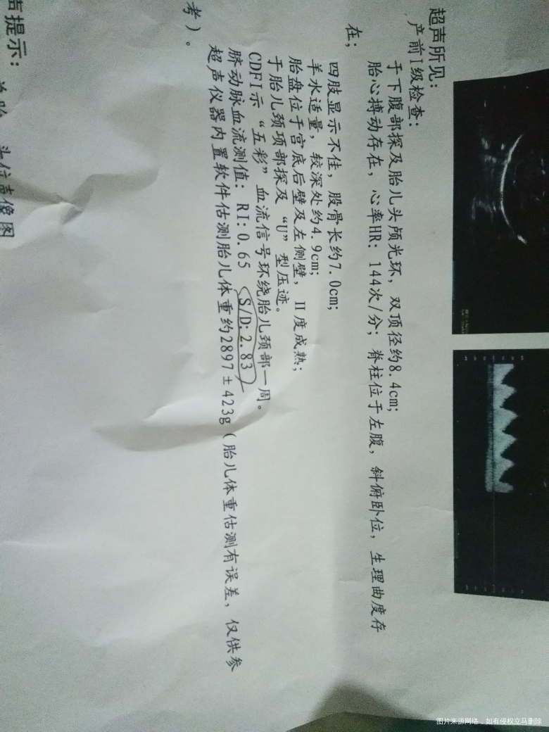 怎么办啊,只能剖腹产还是要看看再说