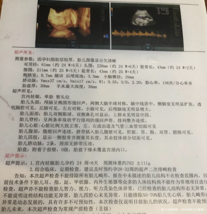 医生帮忙看看思维检查侧脑室值高怎么办