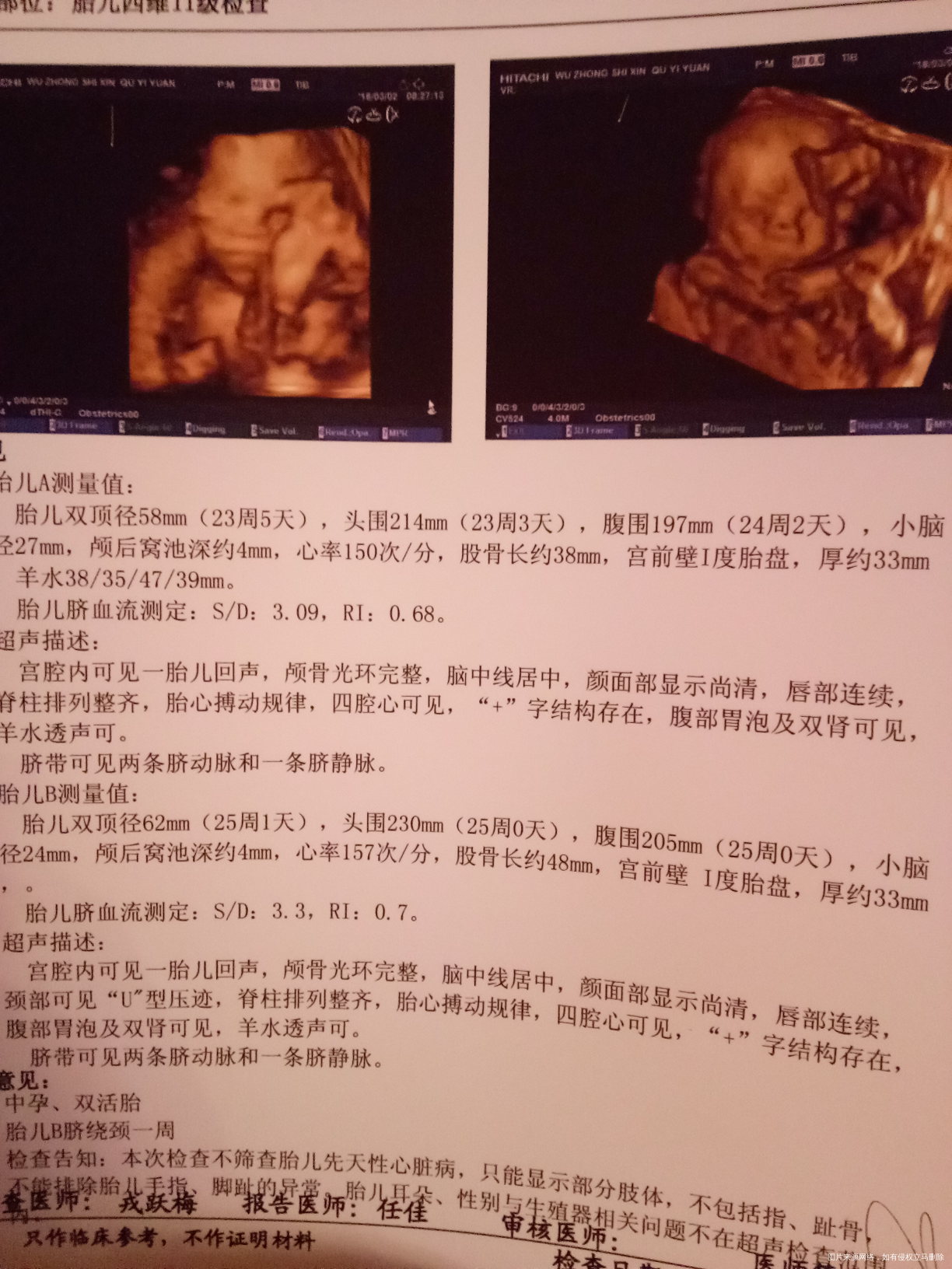 麻烦医生给看看,宝宝是男是女?谢谢!