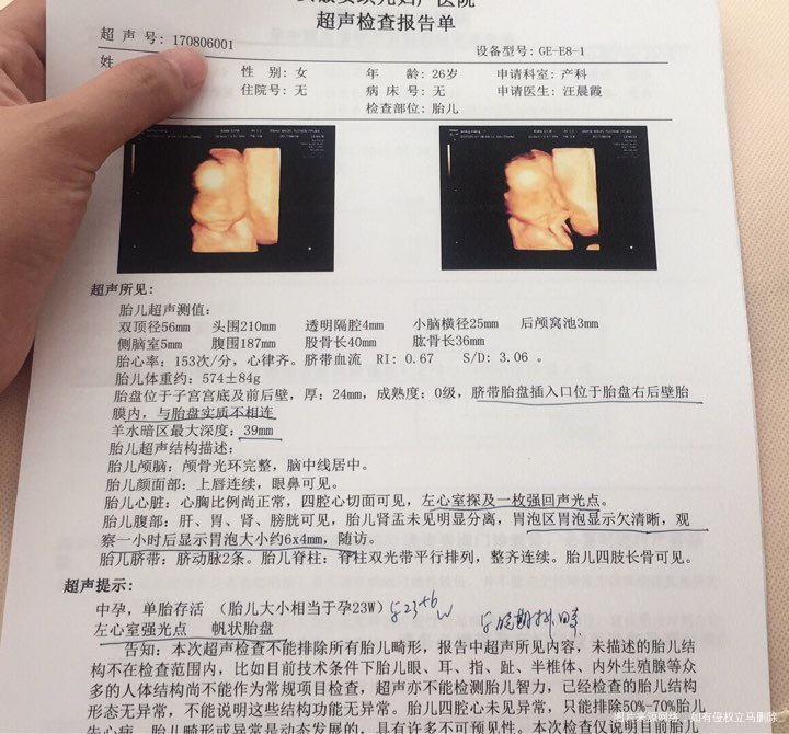 四维彩超结果不理想,让进一步进行小排畸,很担心!