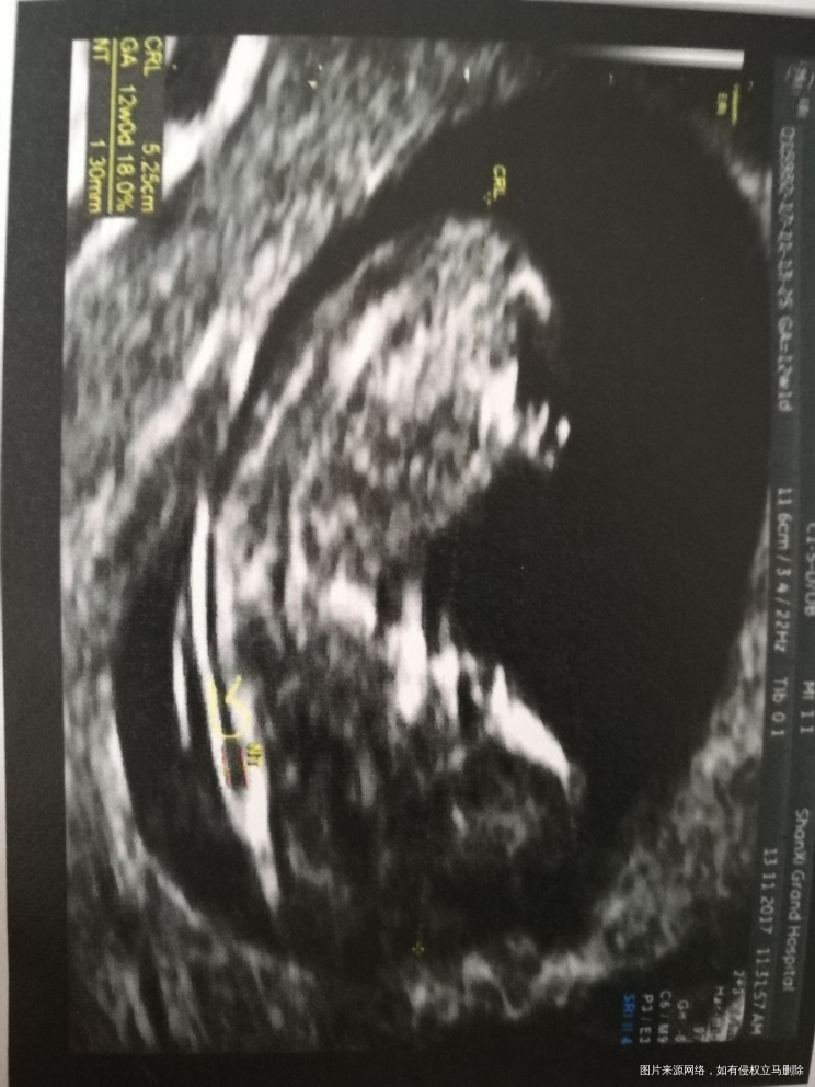 谁会看男孩女孩,来帮我看看