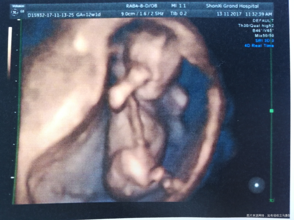 谁会看男孩女孩,来帮我看看