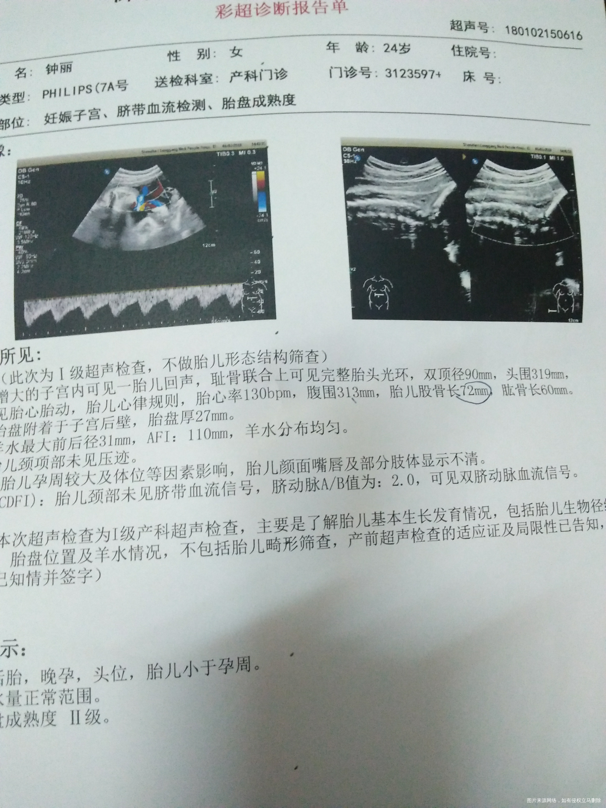 医生请帮我看看宝宝有多重