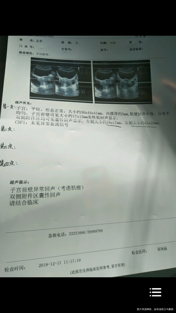 现在附件囊肿复查。急急急