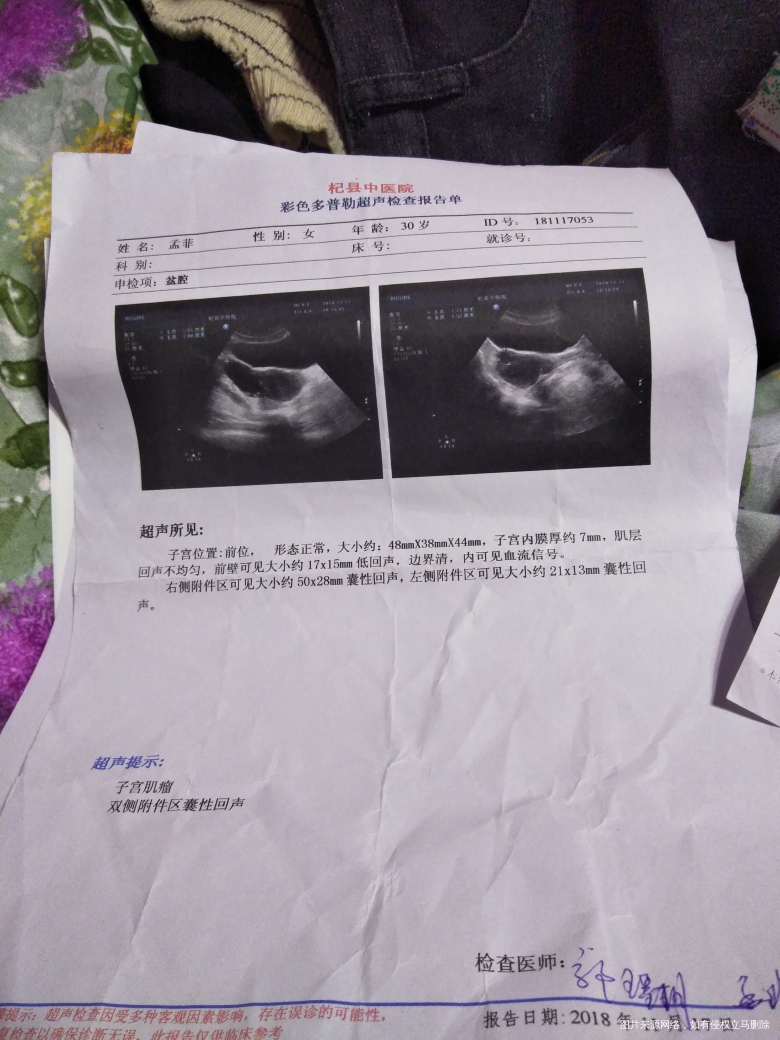 现在附件囊肿复查。急急急