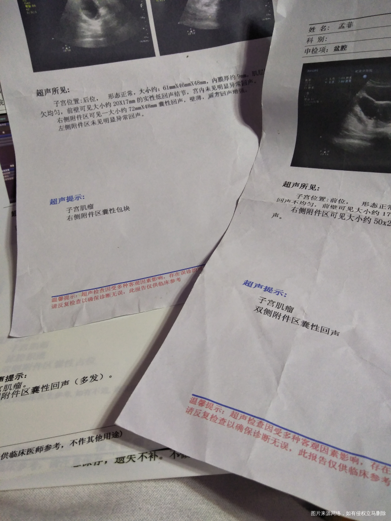 现在附件囊肿复查。急急急