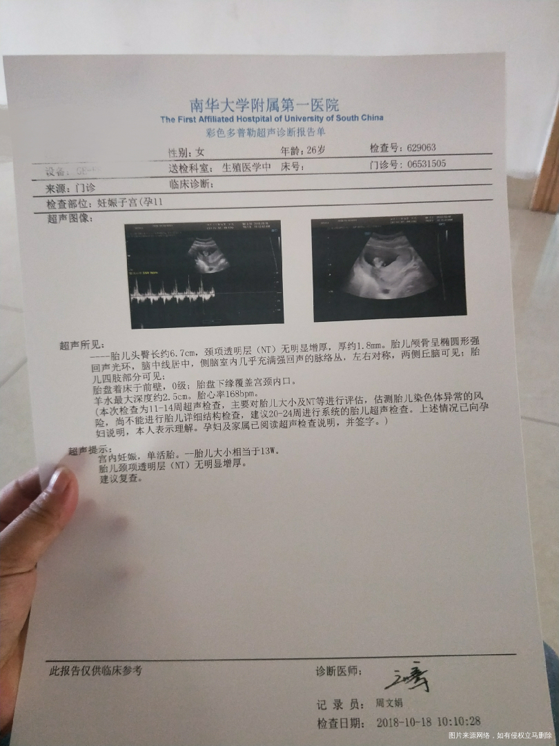 今天12十5做的NT