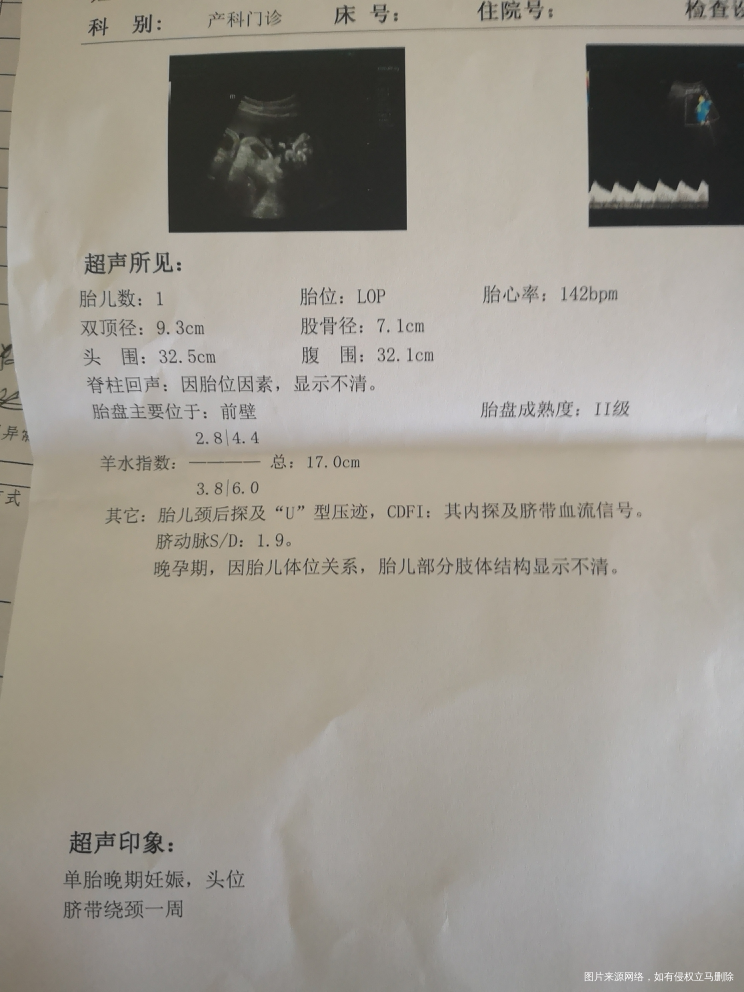 请帮忙看看胎儿有几斤了