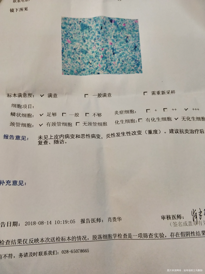 请医生帮我看看我的检查报告