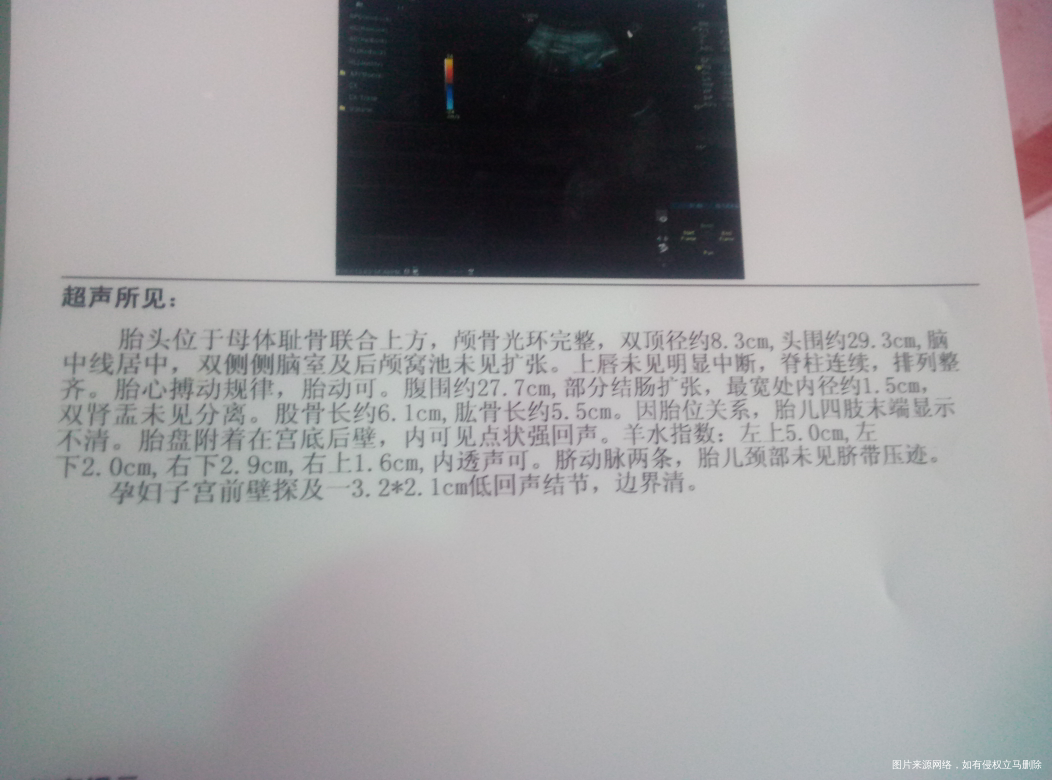 帮我看看吧!好担心啊,谢谢了