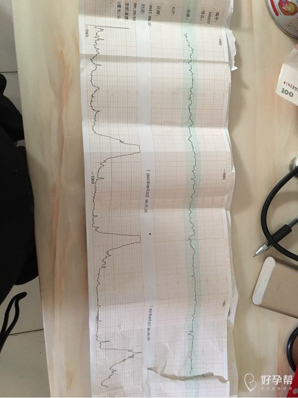孕396周胎心监护显示有宫缩了.但是我一点感觉也没有.什么反应都没有.