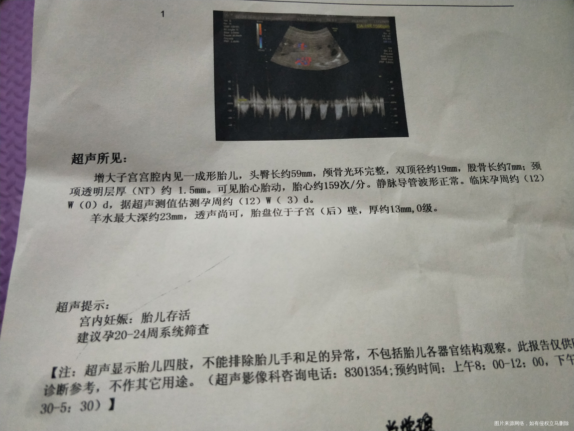 我的NT报告单!宝宝捉迷藏,照B超时
一下平趟一下侧趟着2回才照到,你真淘气!