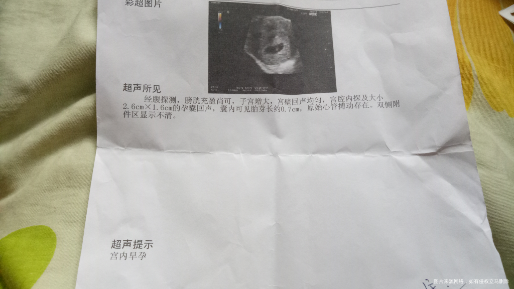 请医生帮我确认一下几周了