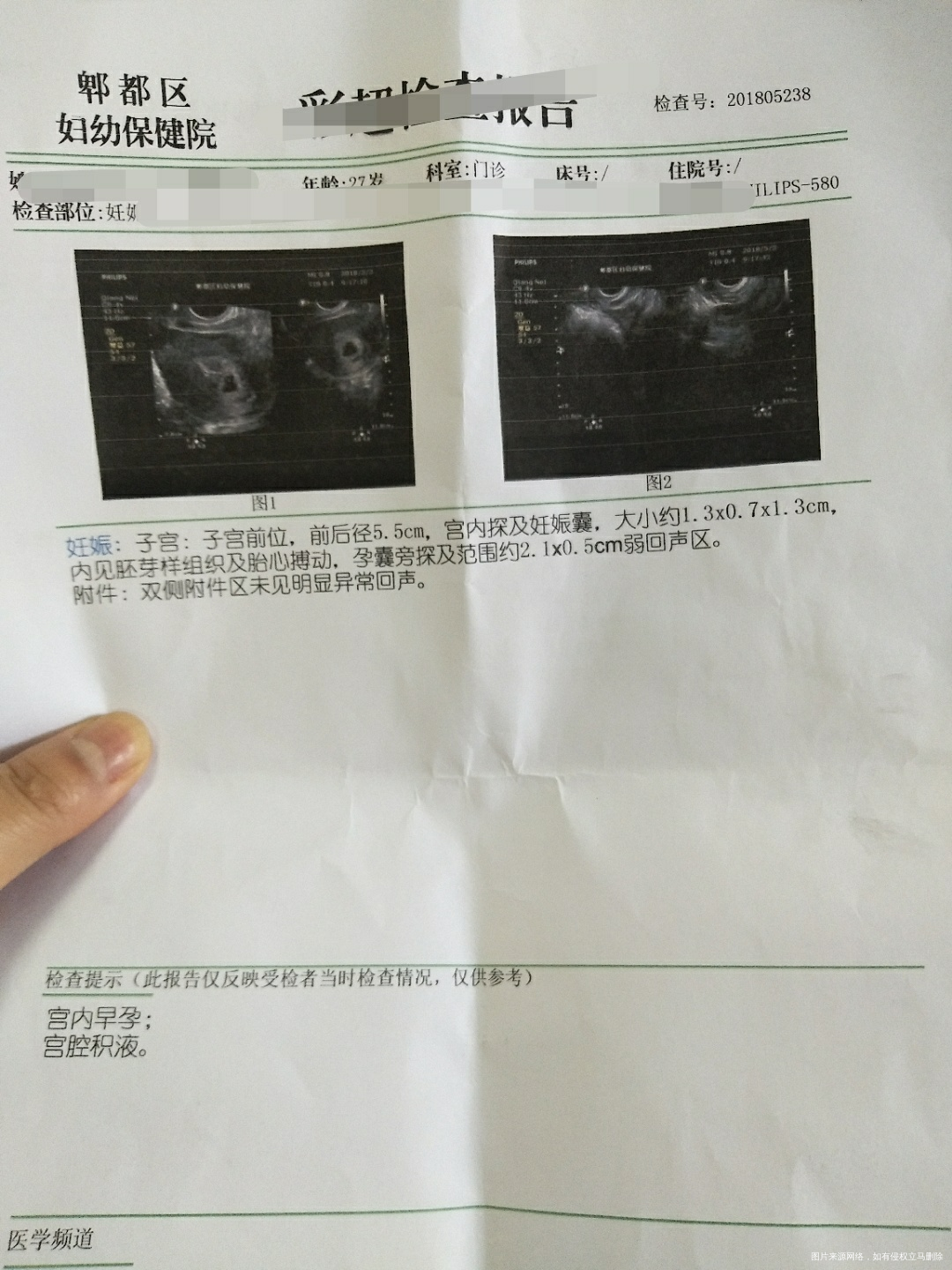 看看正常吗,现在有点出血,需要回家休息吗