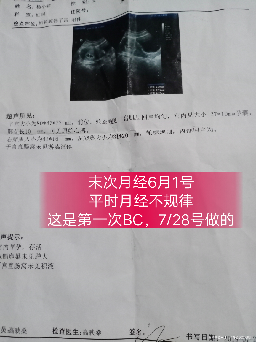 有没有姐妹会算多少周的?末次月经6月1号我这BC单上没写多大,不知道有没有偏小😖