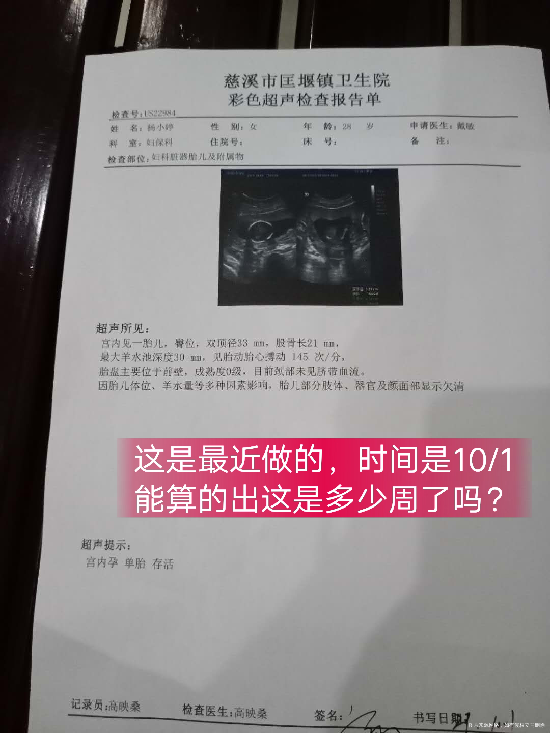 有没有姐妹会算多少周的?末次月经6月1号我这BC单上没写多大,不知道有没有偏小😖
