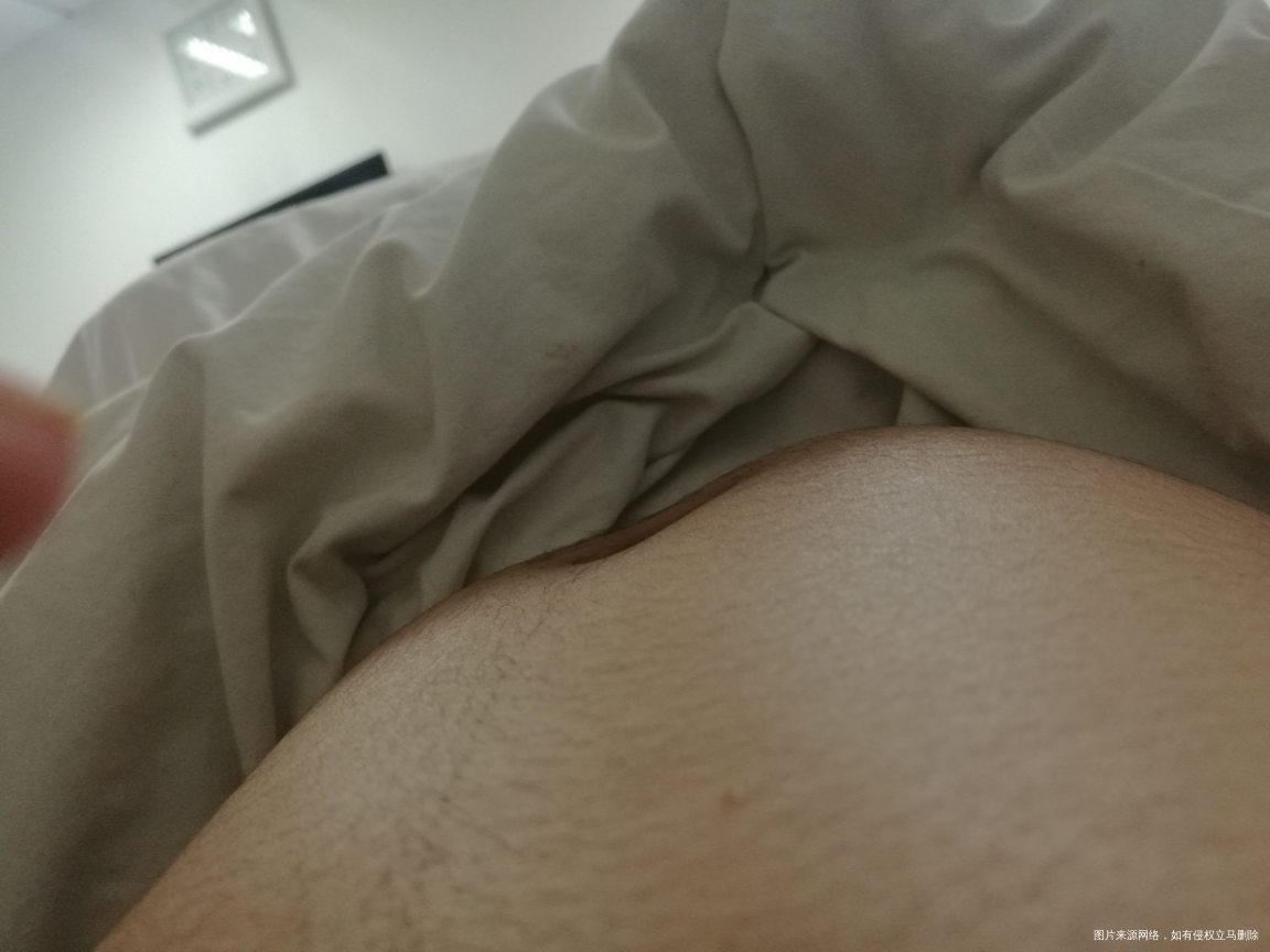 鼓包是不是宫缩,怀孕28+5