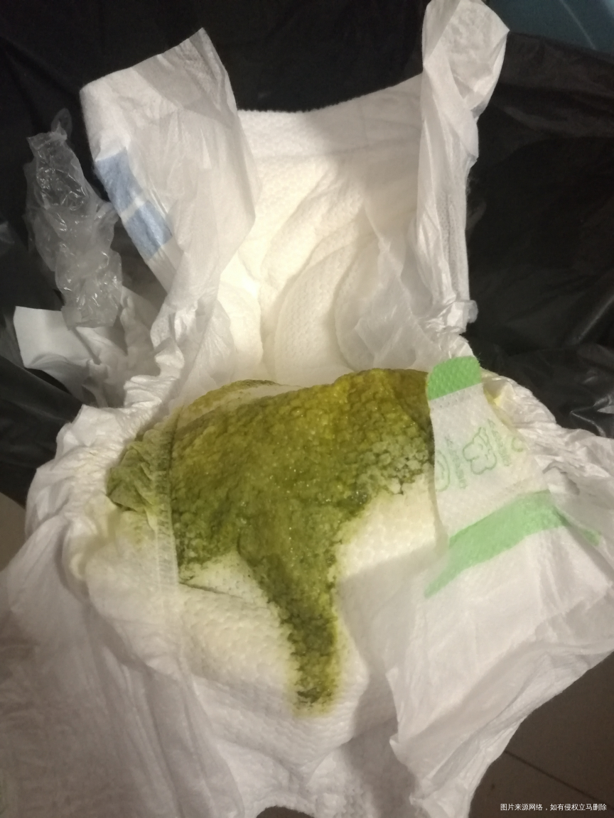 宝宝三个半月了,最近一周吧天天拉绿屎怎么回事