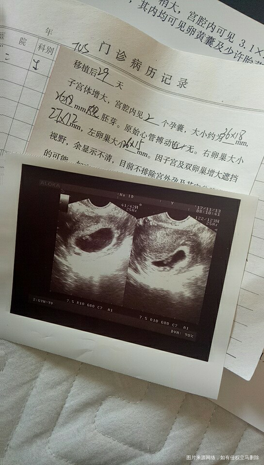 试管这条路真是艰辛,一重一重的火焰山