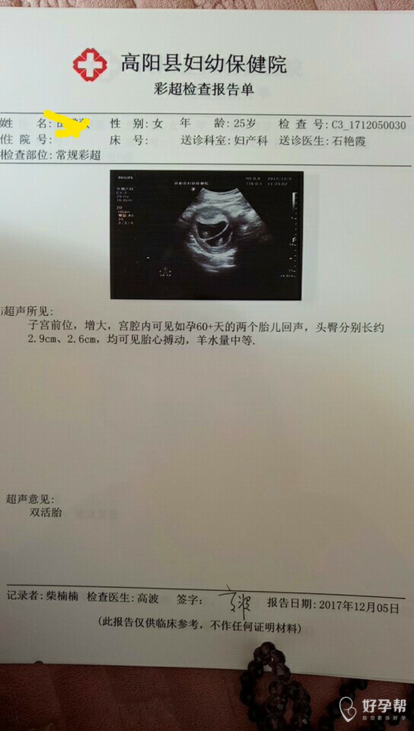 我怀啦移植50天啦今天做了b超一切正常