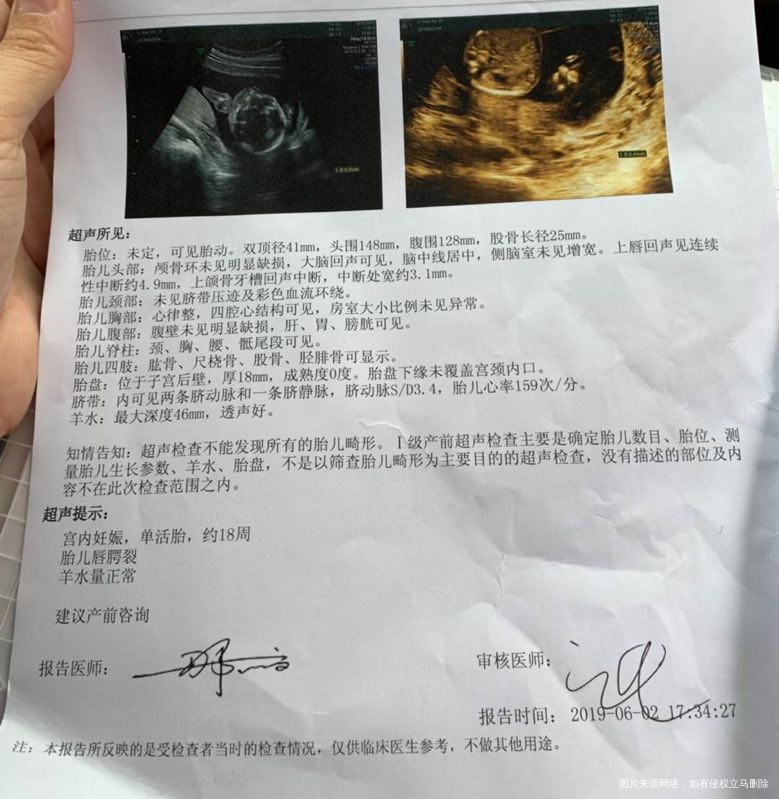 这是18周时的彩超,请问唇腭裂严不严重?