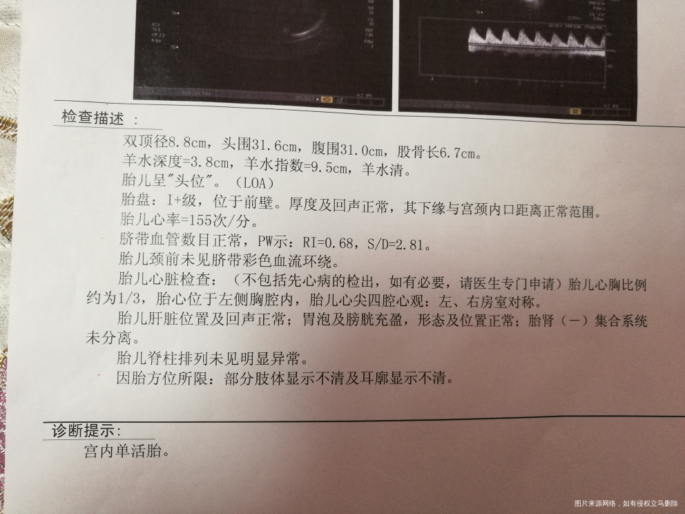 孕37周,胎儿估计有多大?