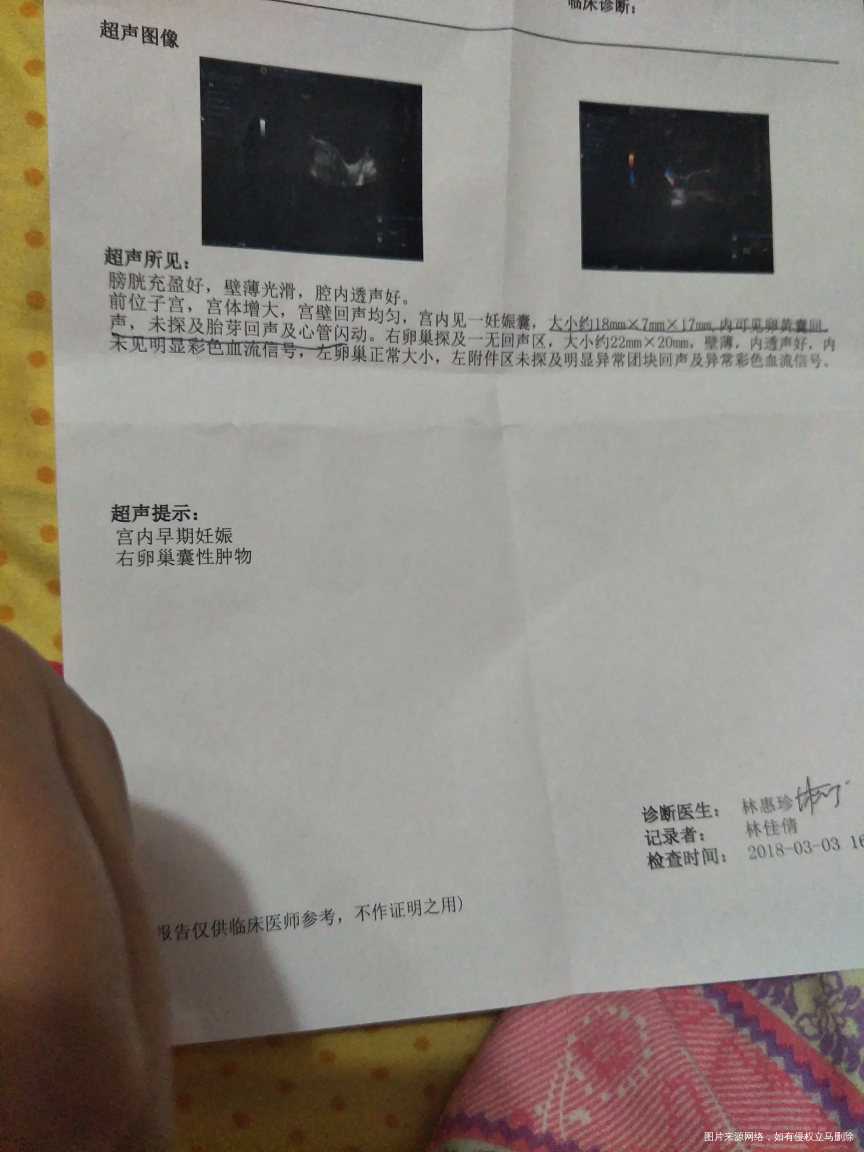 请医生帮忙看看到底有没有事啊