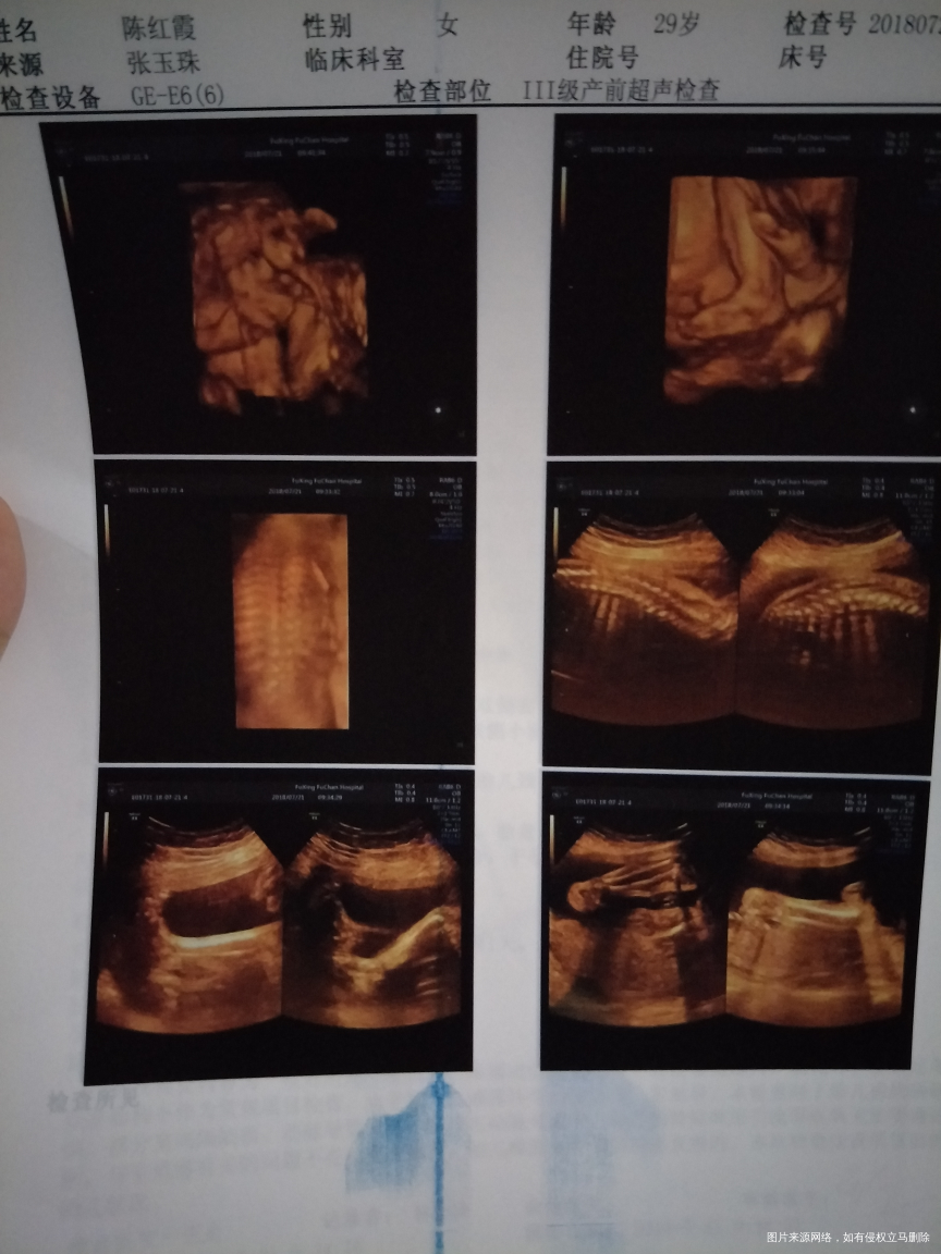 急急急急急急急急急急急