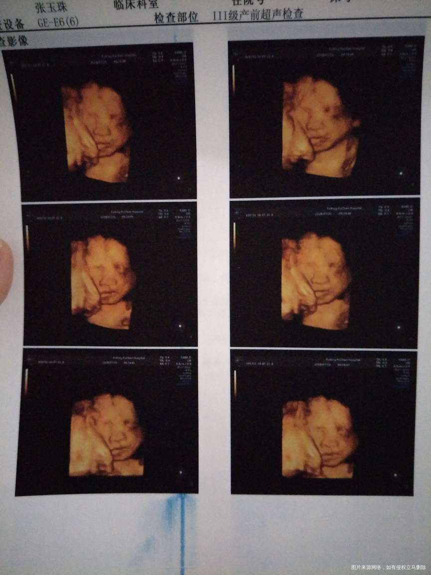 急急急急急急急急急急急