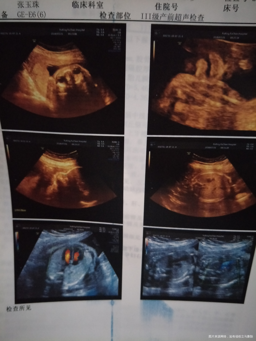 急急急急急急急急急急急