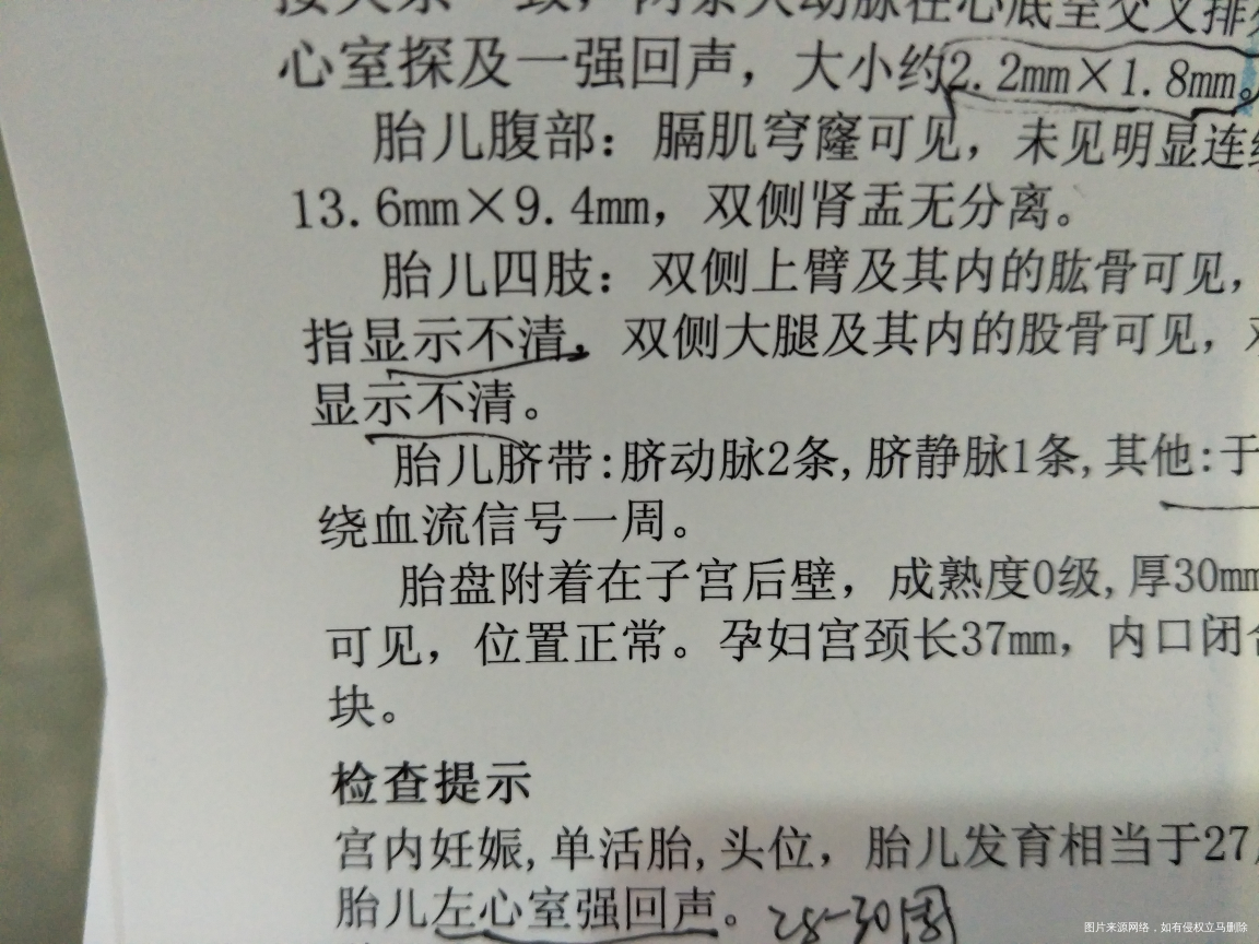 急急急急急急急急急急急急急急