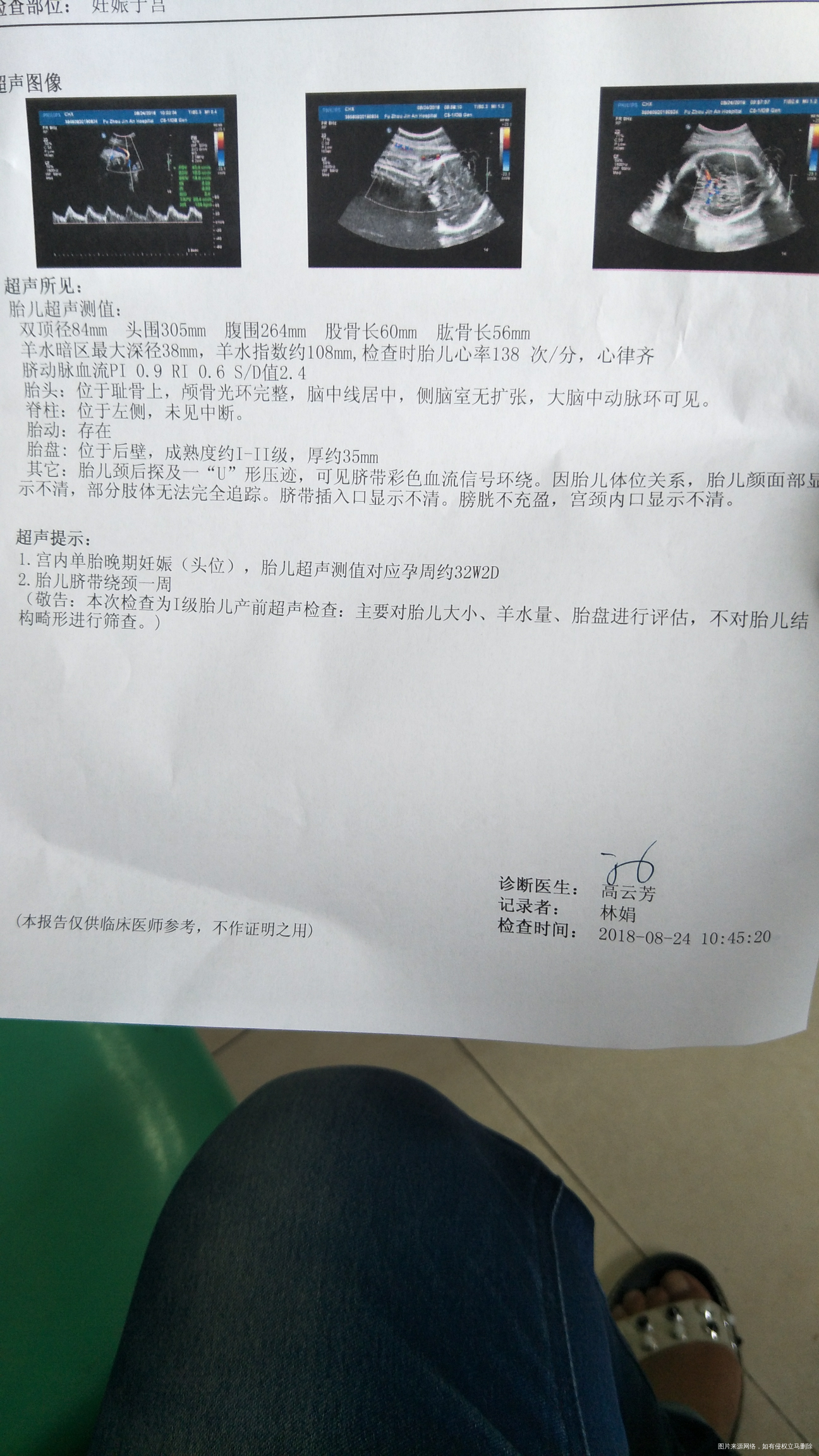 大家帮忙看看是男孩女孩