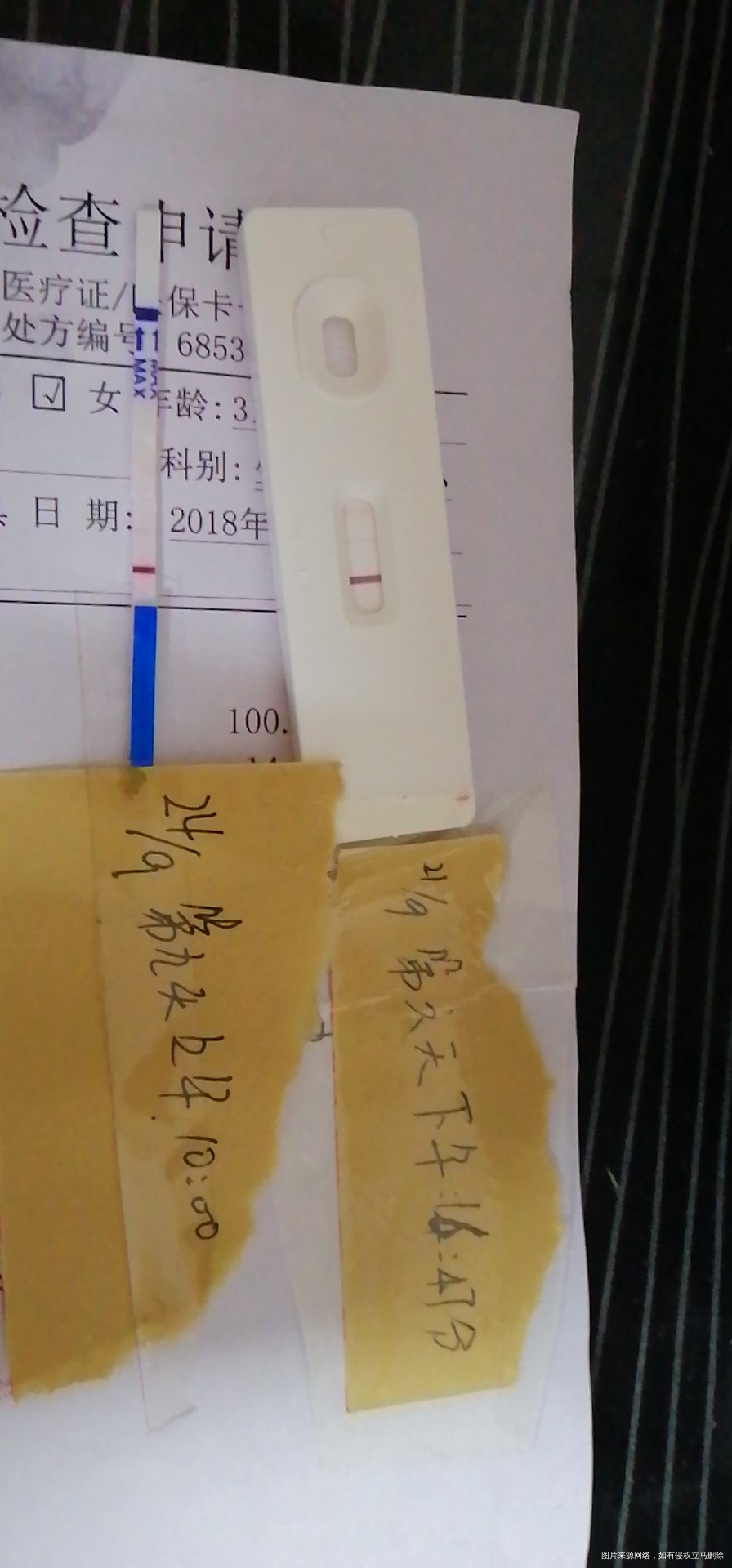 移植的第十天,昨晚开始乳头一碰就有点痛了,肚子没那么坠胀了,昨天测了两条线,但是...