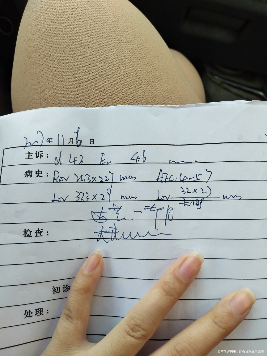 促排以后卵泡没破,囊肿,严重吗